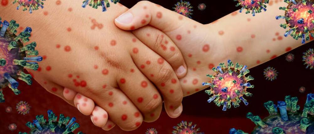 Communicable Disease